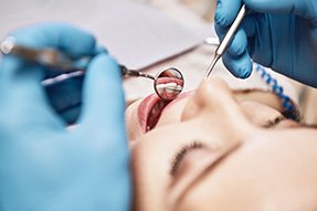 Closeup of woman’s teeth being examined by blue-gloved hands